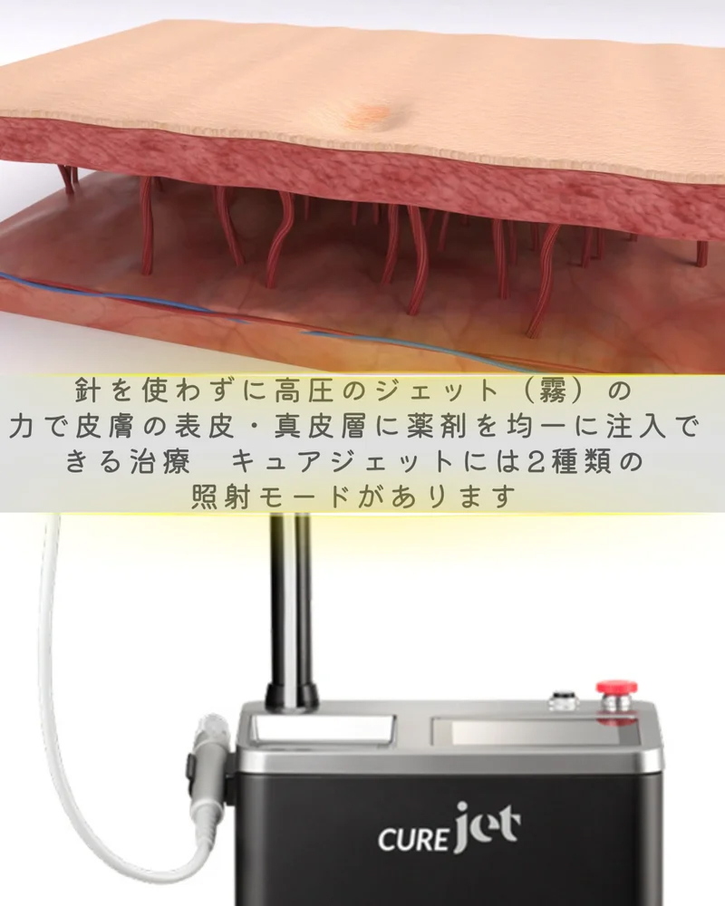 o1080135015638889496