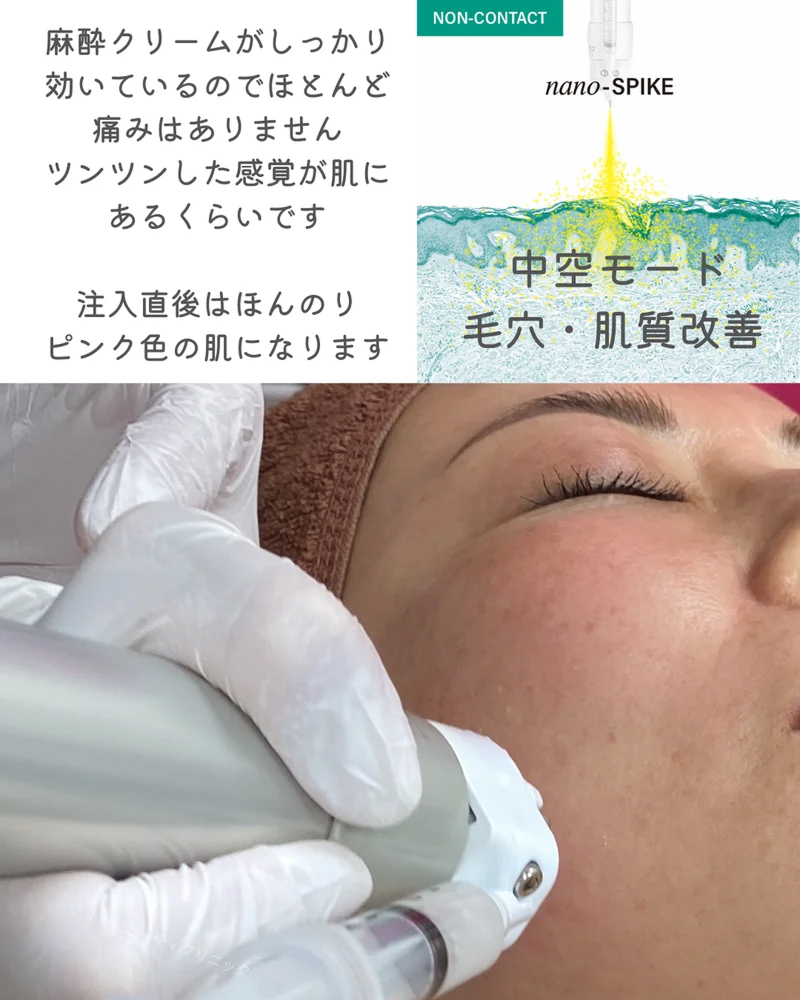 o1080135015638889498