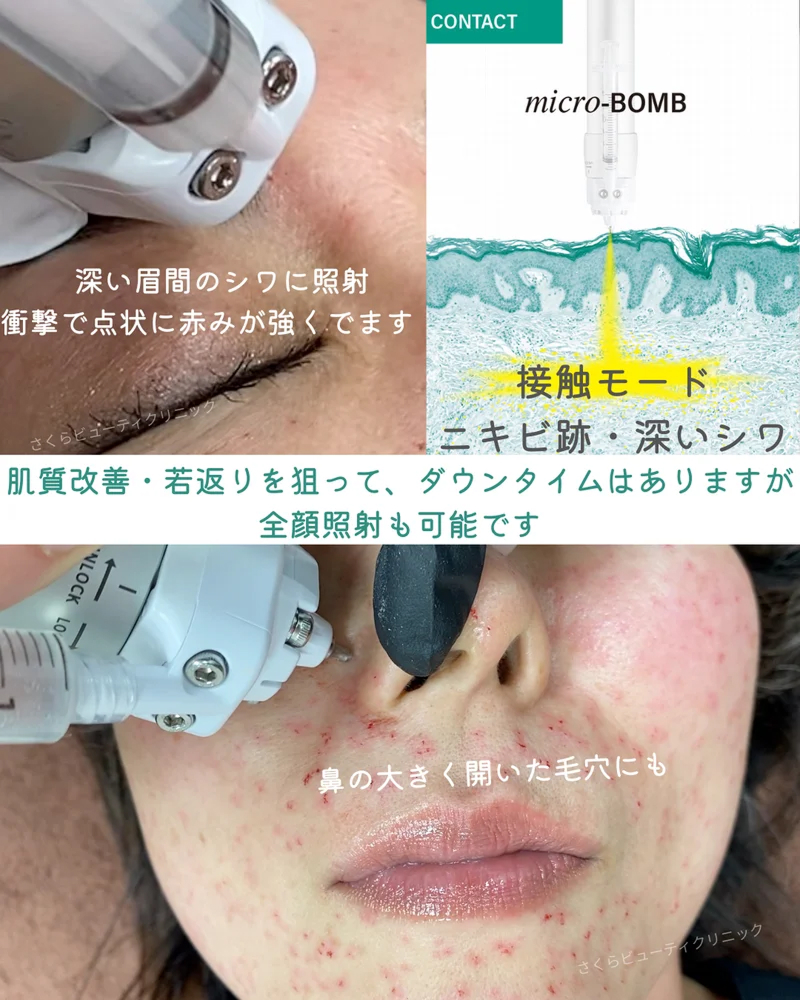 o1080135015638889505
