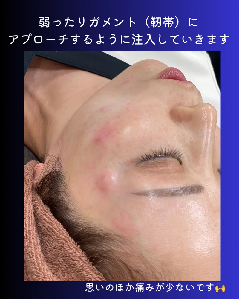 o1080135015646313211