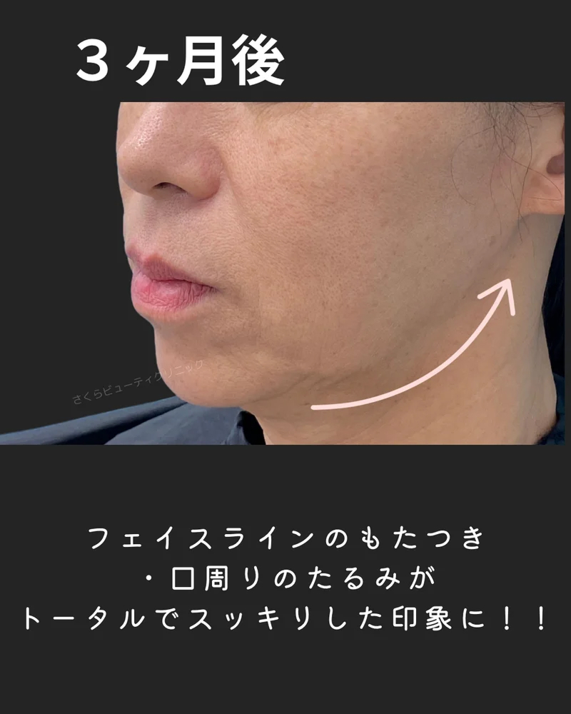 o1080135015661553355