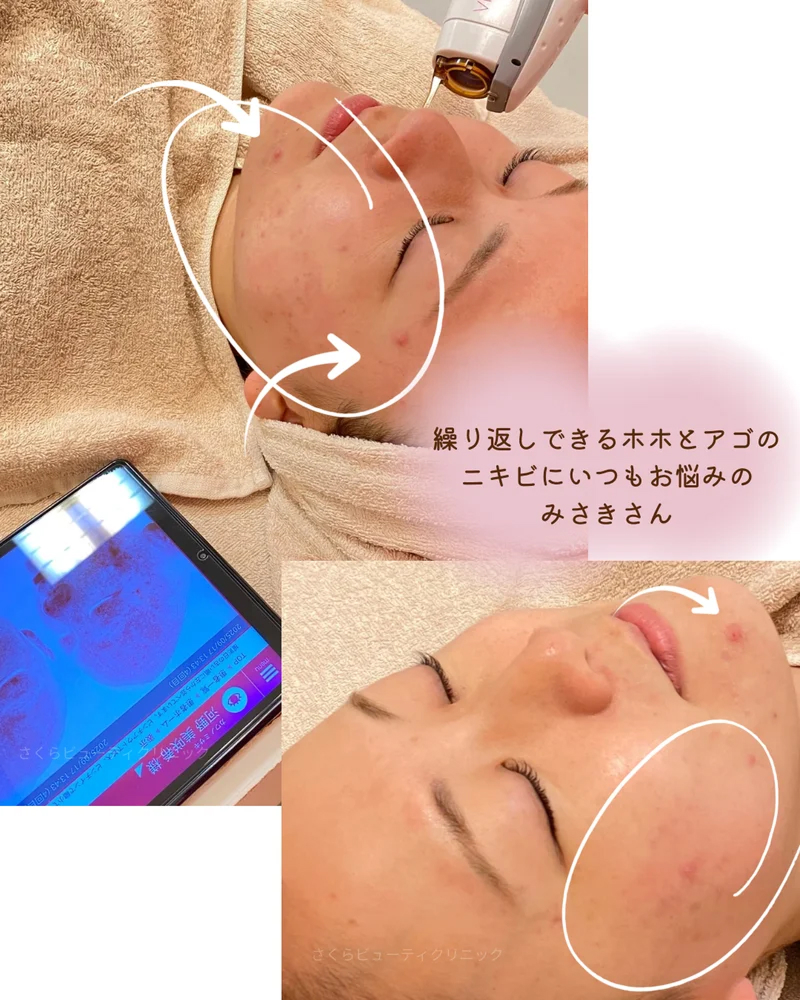 o1080135015689151458
