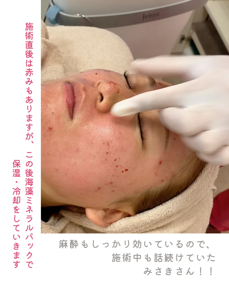 o1080135015689151518