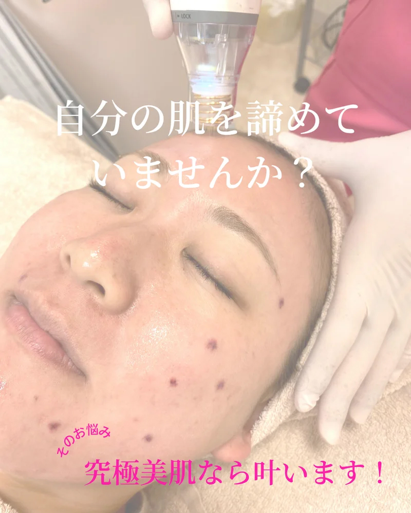 o1080135015705611599