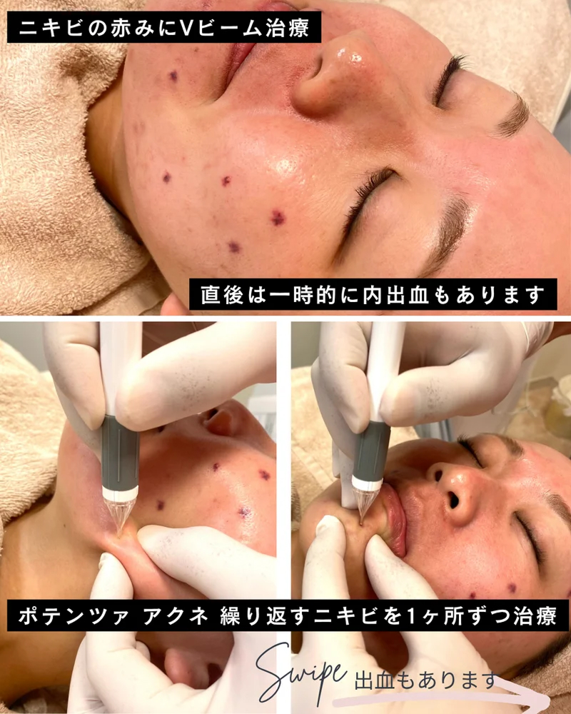 o1080135015705611620