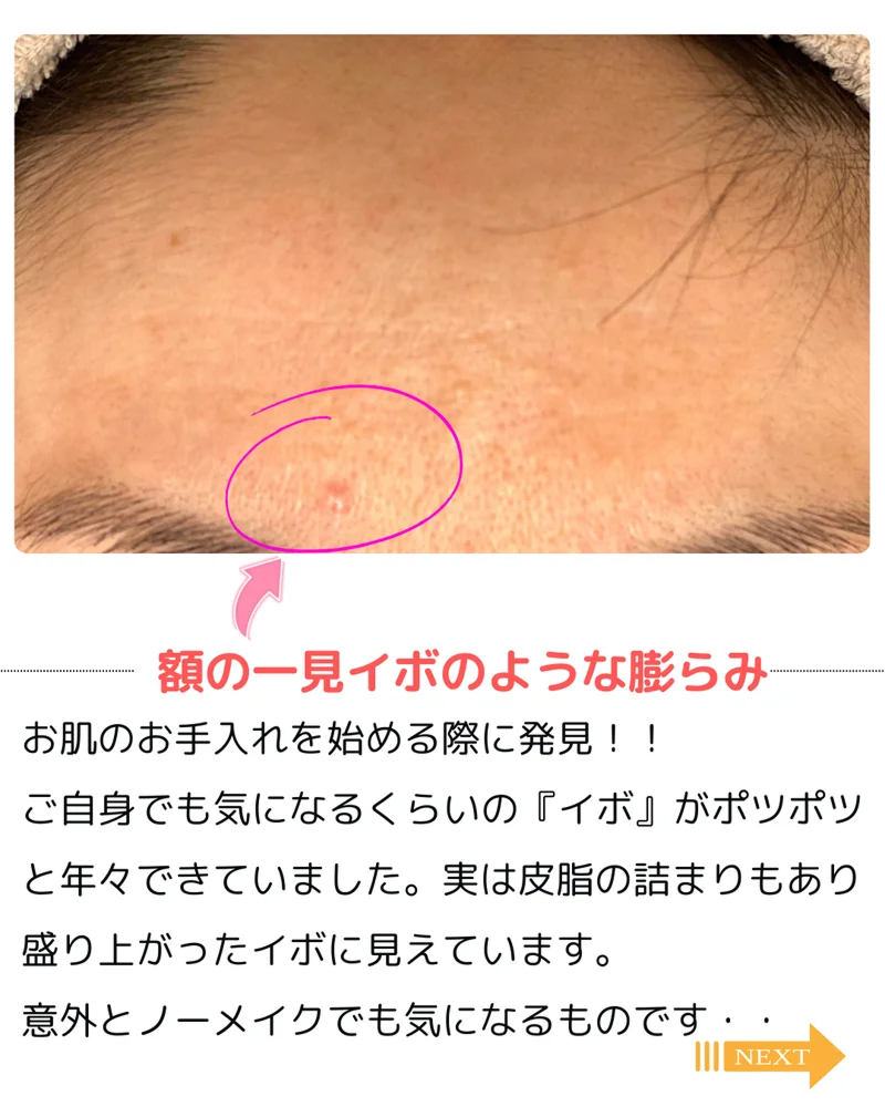 o1080135015744771620