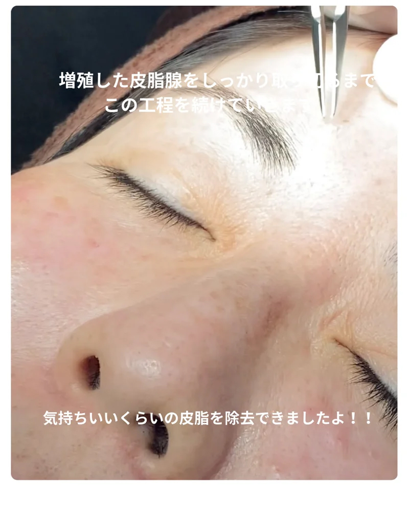 o1080135015744771627