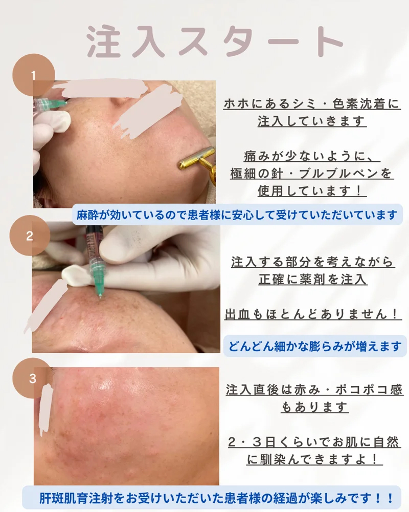 o1080135015748290194