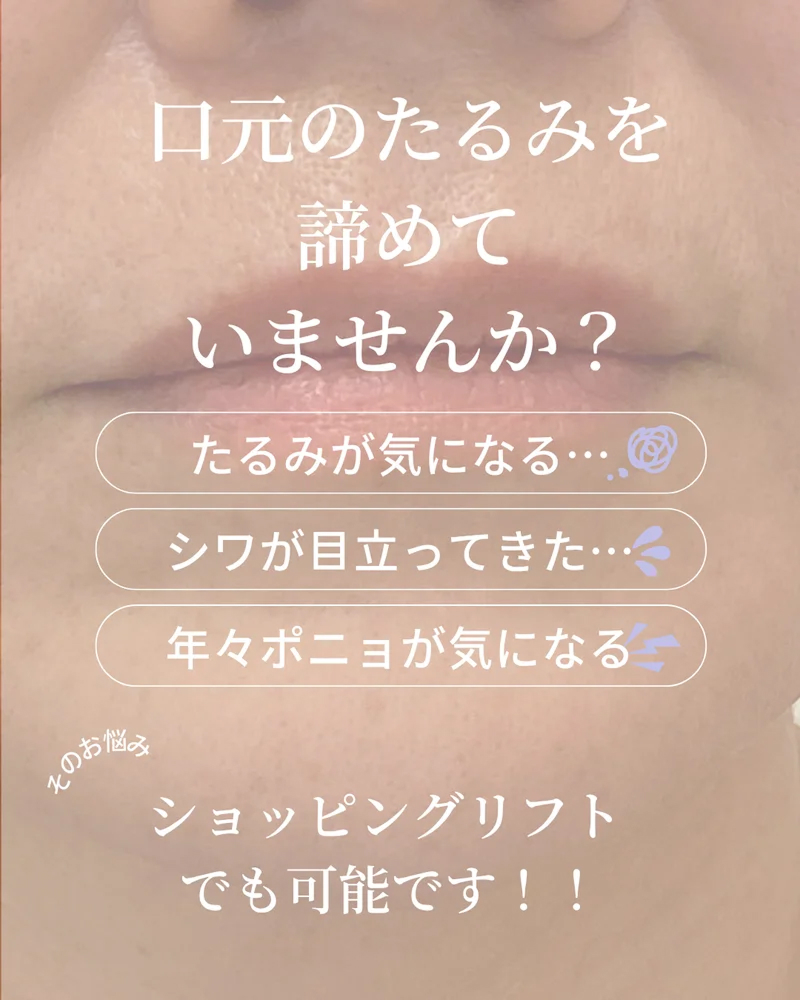 o1080135015779974868