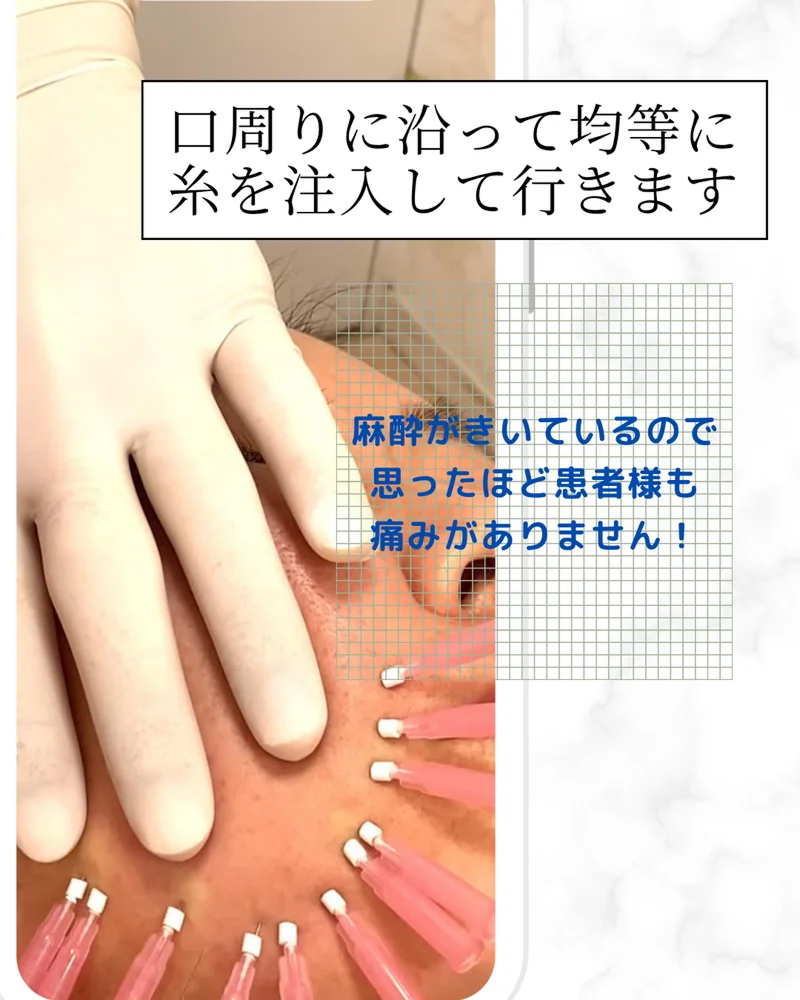 o1080135015779974872