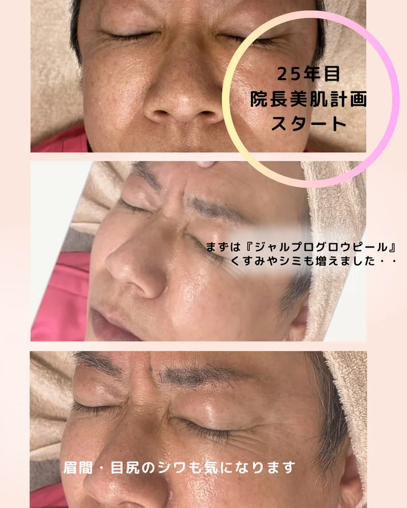 o1080135015797064408