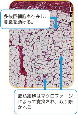 治療14日後