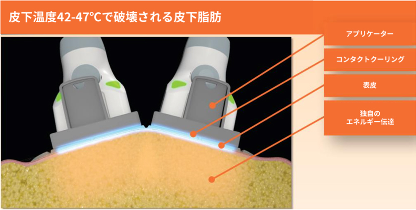 スカルプシュアの特徴