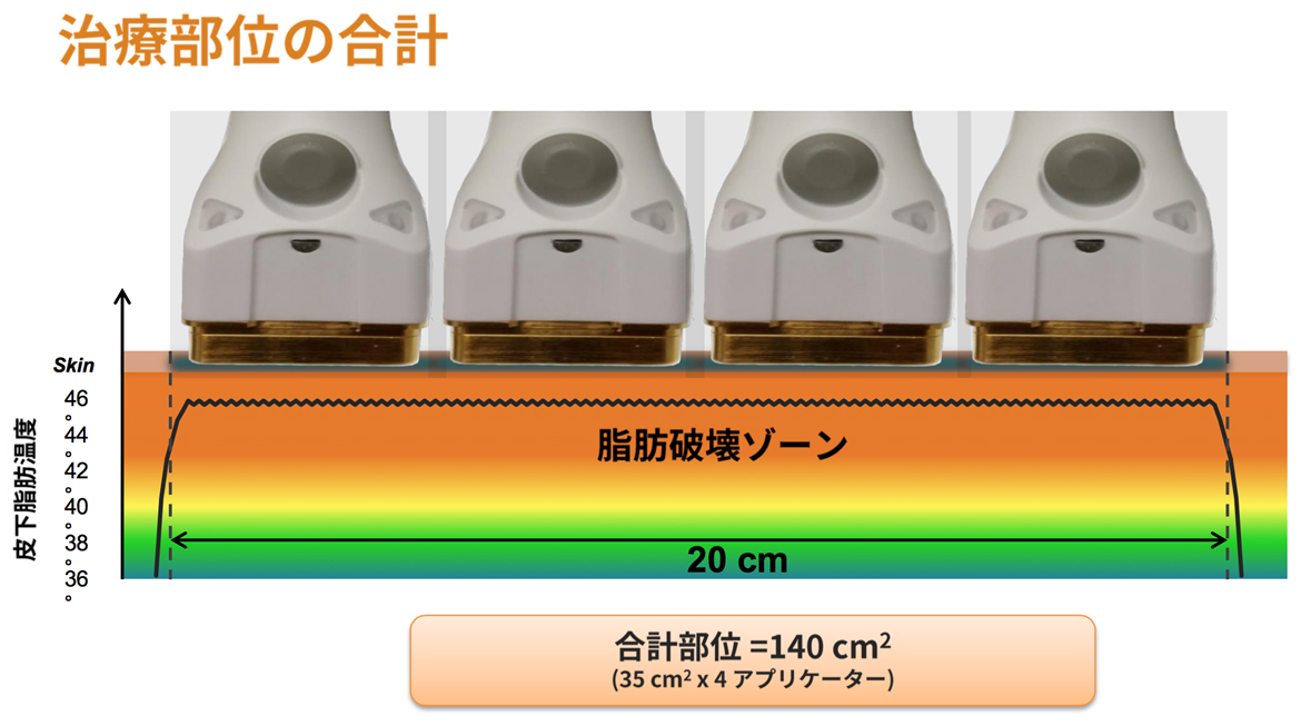 スカルプシュアの特徴