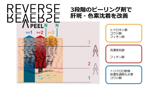 リバースピール の特徴