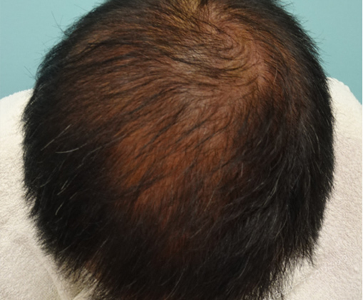 症例写真3before