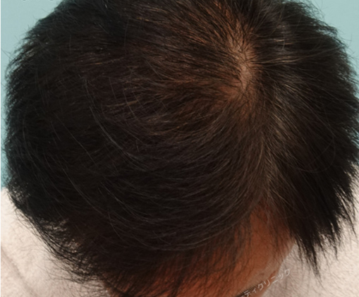 症例写真5after