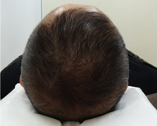 症例写真7after