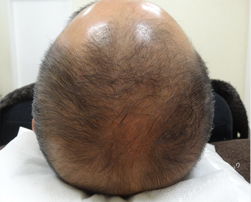 症例写真7before