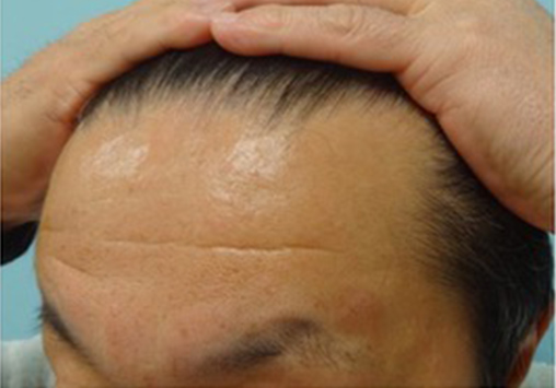症例写真10before